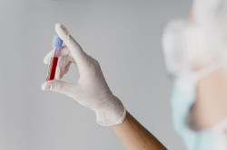 Cantabria celebra ma&ntilde;ana el D&iacute;a del Donante de Sangre con una colecta en Valdecilla y Los Corrales