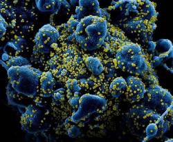 Ciencia ficci&oacute;n siglo XXI el coronavirus se escapa de las vacunas y muta  
