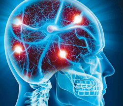Descubierto el circuito cerebral indica cu&aacute;ndo hay que dejar de comer y regularlo podr&iacute;a ayudar a combatir la obesidad