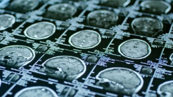 Descubren c&oacute;mo reactivar las c&eacute;lulas madre envejecidas en el cerebro
