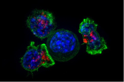 Dise&ntilde;an c&eacute;lulas gen&eacute;ticamente y ocultas en bioc&aacute;psulas para atacar tumores s&oacute;lidos desde dentro