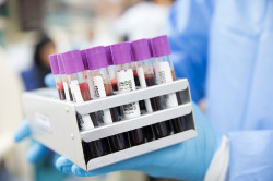 El aprendizaje autom&aacute;tico podr&iacute;a ayudar a identificar a personas con mayor riesgo de desarrollar c&aacute;ncer, seg&uacute;n estudio