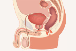 El c&aacute;ncer de pr&oacute;stata puede no dar s&iacute;ntomas y esperar a notarlos aumenta el riesgo de progresi&oacute;n, seg&uacute;n ur&oacute;logo