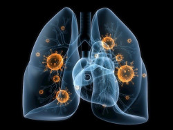 El c&aacute;ncer de pulm&oacute;n en no fumadores es una enfermedad distinta al de los fumadores y no responde igual al tratamiento