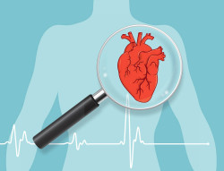 Factores de riesgo cardiovascular, relacionados con las complicaciones del COVID-19 y la muerte