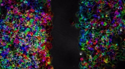 Investigadoras del CSIC muestran la efectividad de una terapia ultras&oacute;nica contra el c&aacute;ncer de p&aacute;ncreas
