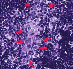 Investigadores identifican un posible objetivo farmacol&oacute;gico para el c&aacute;ncer de pr&oacute;stata