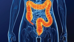 La combinaci&oacute;n de una quimioterapia triple mejora los resultados del c&aacute;ncer colorrectal metast&aacute;sico