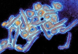 La OMS confirma un brote potencialmente letal del virus de Marburgo en Etiop&iacute;a