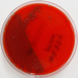 Las bacterias causantes de la meningitis pueden percibir la fiebre para evitar la eliminaci&oacute;n inmunitaria