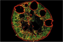 Las c&eacute;lulas an&oacute;malas que se convierten en c&aacute;ncer de es&oacute;fago comienzan su vida como c&eacute;lulas del est&oacute;mago