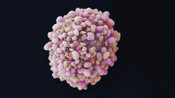Los c&aacute;nceres de mama triple negativo siguen acumulando cambios gen&eacute;ticos durante el crecimiento del tumor