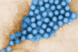Los cient&iacute;ficos identifican m&aacute;s de 140.000 especies de virus en el intestino humano