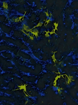 Los cient&iacute;ficos trabajan para las inmunoterapias contra el c&aacute;ncer con menos efectos secundarios