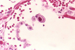 Los herpesvirus entran en estado latente para adaptarse en diferentes condiciones y sobrevivir