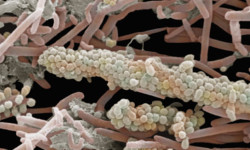 Los hongos que viven en el intestino tambi&eacute;n influyen en la salud y la enfermedad