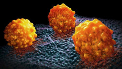 Los investigadores encuentran un nuevo objetivo terap&eacute;utico para el c&aacute;ncer de p&aacute;ncreas