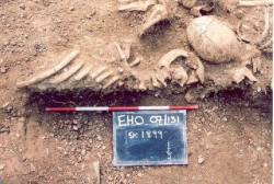 Los vikingos padec&iacute;an viruela y pudieron haber ayudado a propagar el virus m&aacute;s mortal del mundo