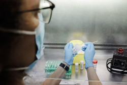 Sanidad confirma 225 casos positivos de viruela del mono y otros 439 sospechosos en Espa&ntilde;a