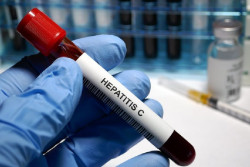 Sanidad destaca el liderazgo de Espa&ntilde;a en la eliminaci&oacute;n de la hepatitis C y urge a detectar los casos no diagnosticados