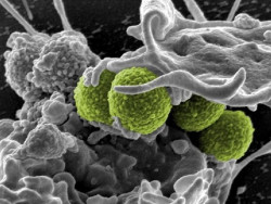 Surge una nueva estrategia para la vacuna contra el `estafilococo aureus` resistente a la meticilina