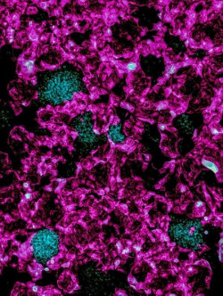 Un avance en medicina regenerativa puede conducir a nuevos tratamientos para las complicaciones de la placenta