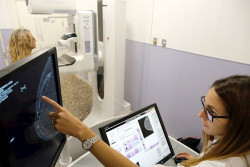 Un estudio aporta nuevas estimaciones de los riesgos de c&aacute;ncer de mama asociados con la terapia de reemplazo
