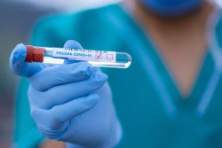 Un estudio busca la prueba de COVID-19 apropiada para cada una de las etapas de la infecci&oacute;n por coronavirus