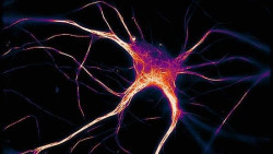 Un estudio espa&ntilde;ol relaciona cambios en la materia blanca del cerebro con el avance del Alzheimer