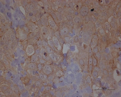 Un modelo experimental de c&aacute;ncer de ovario muestra el efecto de la disposici&oacute;n de las c&eacute;lulas sanas en la met&aacute;stasis