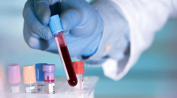 Un nuevo estudio brinda esperanza para un diagn&oacute;stico r&aacute;pido de ELA mediante muestras de sangre