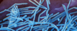 Una nueva t&eacute;cnica permite estudiar por primera vez en vivo las infecciones por virus