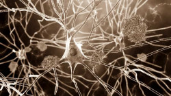Una t&eacute;cnica de imagen no invasiva permite localizar por primera vez los microtrombos que agravan el Alzheimer